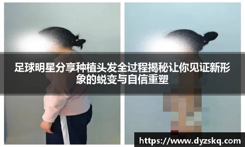足球明星分享种植头发全过程揭秘让你见证新形象的蜕变与自信重塑